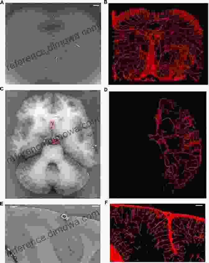 3D Image Of A Brain Obtained Using Synchrotron Radiation Microtomography Applications Of Synchrotron Radiation: Micro Beams In Cell Micro Biology And Medicine (Biological And Medical Physics Biomedical Engineering)